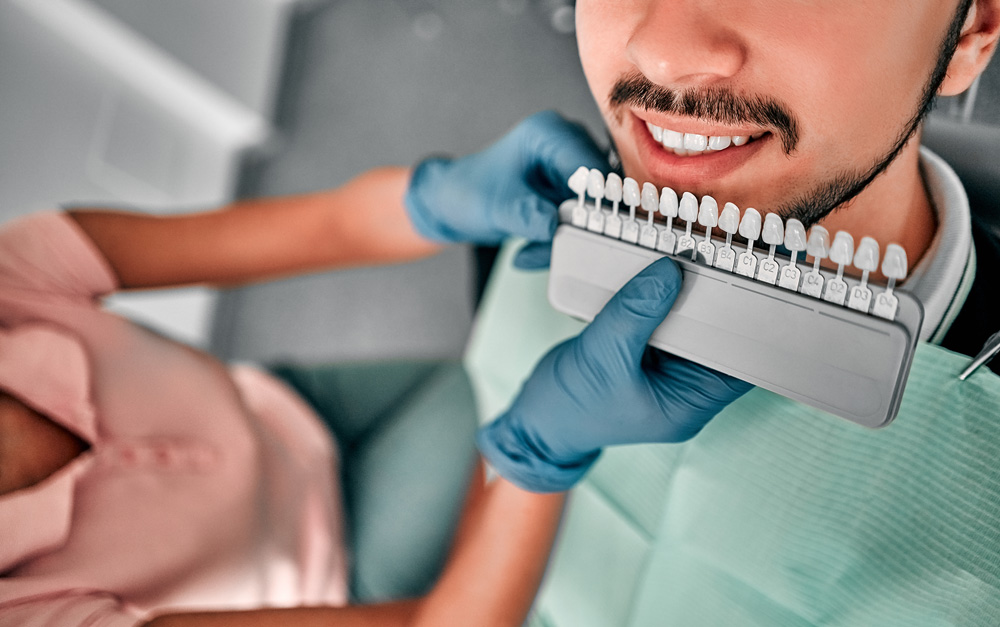Veneers Lance Family Dental - Best Dentist in Festus, MO