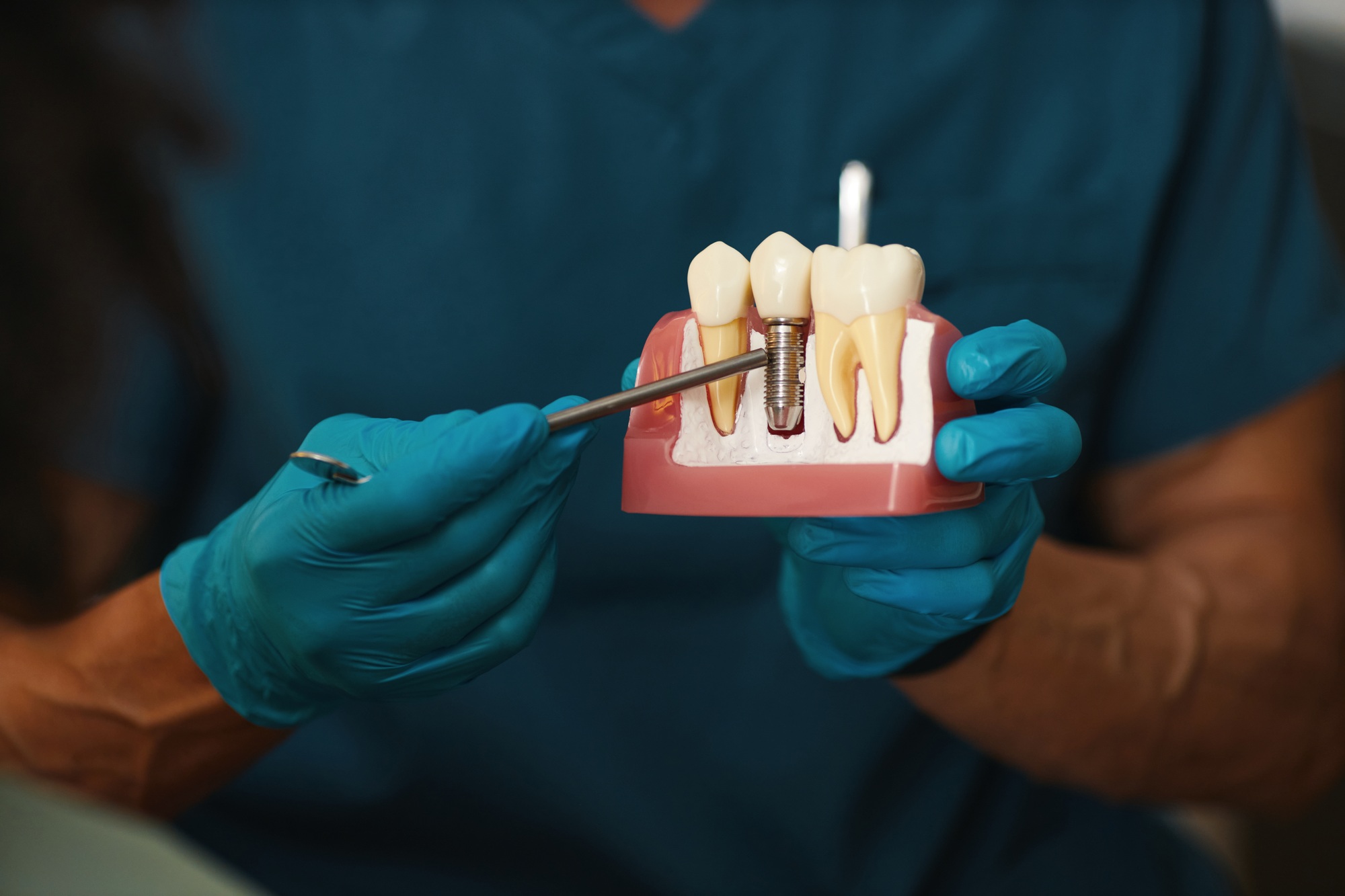 Dentist at Lance Family Dental in Festus, MO demonstrating a dental implant model to educate patients on proper implant care and long-term oral health.