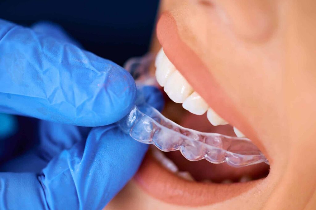 Close up of female patient getting dental aligner