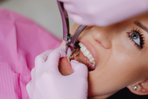 A dentist performing tooth extraction to a female patient