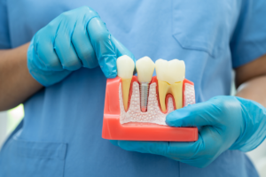 Dentist explaining root canal and tooth extraction options to a patient in Festus, MO